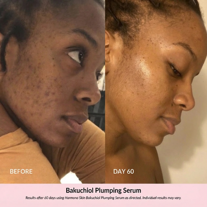 Harmona Skin™ Bakuchiol